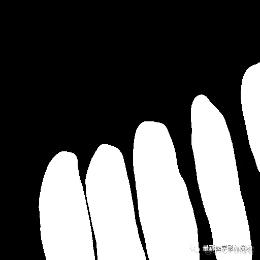 Tensorflow入门教程（十三）——医学图像分割案例_数据_08